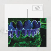 Carte Postale Dents folles Modèle Dentiste Orthodontiste (Devant / Derrière)