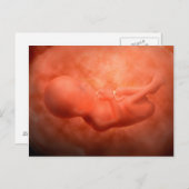 Carte Postale Développement Du Foetus À 24 Semaines (Devant / Derrière)