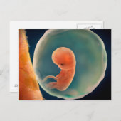 Carte Postale Développement Du Foetus À 9 Semaines (Devant / Derrière)
