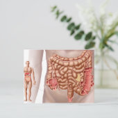 Carte Postale Diverticulite Dans La Région Du Colon Descendant (Debout devant)