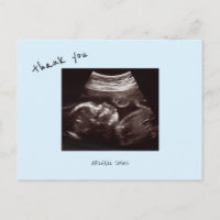 Échographie Baby Shower Cute Bleu Glacé Merci
