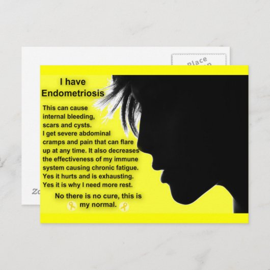 Carte Postale Endovie (Devant / Derrière)