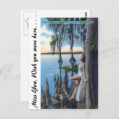 Carte Postale Étude des genoux (Devant / Derrière)