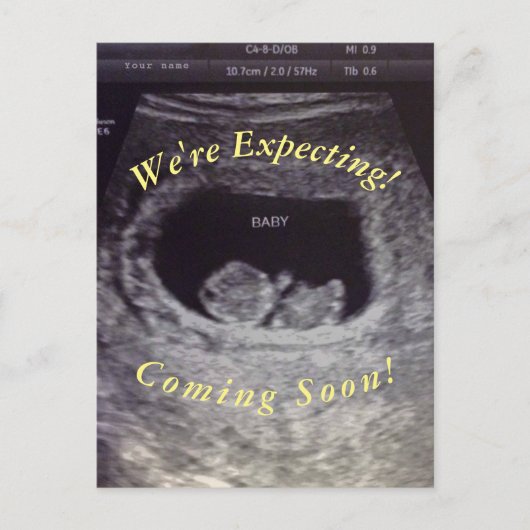 Carte Postale Faux, Prank Pregancy  (Devant)