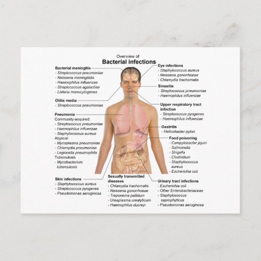 Carte Postale Graphique des infections bactériennes chez l'homme (Devant)