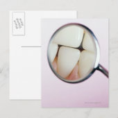 Carte Postale Gros plan des dents reflété dans le miroir dentair (Devant / Derrière)
