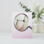 Carte Postale Gros plan des dents reflété dans le miroir dentair (Debout devant)