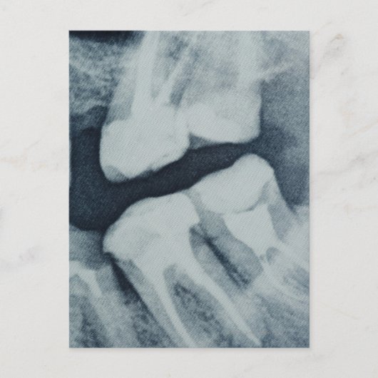 Carte Postale Gros plan d'une radiographie dentaire (Devant)