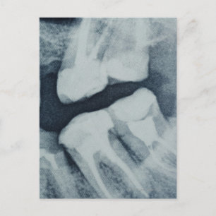 Carte Postale Gros plan d'une radiographie dentaire