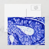 Carte Postale Helicobacter Pylori (Devant / Derrière)