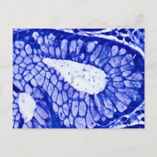 Carte Postale Helicobacter Pylori (Devant)