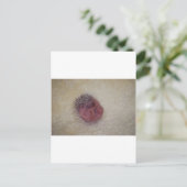 Carte Postale Hérisson bébé (Debout devant)