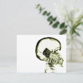 Carte Postale Iellow X-Ray Vision Skeleton (Debout devant)
