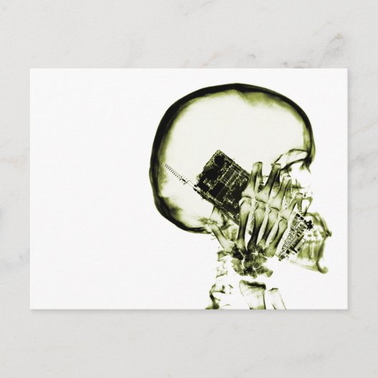 Carte Postale Iellow X-Ray Vision Skeleton (Devant)