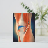 Carte Postale Illustration Médicale : Inflammation Dans Le Genou (Debout devant)