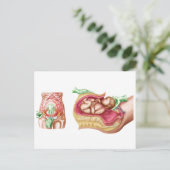 Carte Postale Illustration Montrant La Livraison Cesarienne Du F (Debout devant)