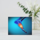 Carte Postale Image Conceptuelle De La Douleur Dans Le Pied Huma (Debout devant)