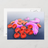 Carte Postale Image Conceptuelle De L'Anémie Des Cellules De Fau (Devant / Derrière)