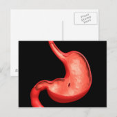Carte Postale Image Conceptuelle De L'Ulcère Peptique En Estomac (Devant / Derrière)
