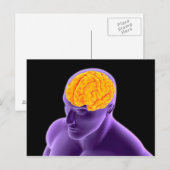 Carte Postale Image Conceptuelle Du Cerveau Humain 8 (Devant / Derrière)