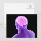 Carte Postale Image Conceptuelle Du Cerveau Humain 9 (Devant / Derrière)