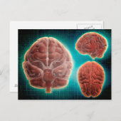 Carte Postale Image Conceptuelle Du Cerveau Humain À Différentes (Devant / Derrière)
