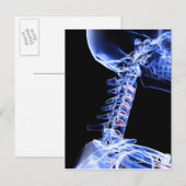 Carte Postale Image par rayons X des os du cou (Devant / Derrière)