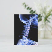 Carte Postale Image par rayons X des os du cou (Debout devant)