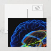 Carte Postale Image par rayons X du cerveau (Devant / Derrière)