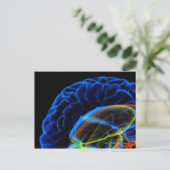 Carte Postale Image par rayons X du cerveau (Debout devant)