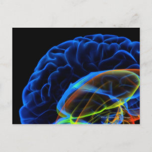 Carte Postale Image par rayons X du cerveau
