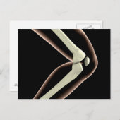 Carte Postale Image X-Ray Du Genou 1 (Devant / Derrière)