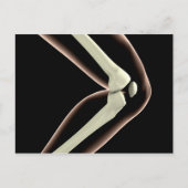 Carte Postale Image X-Ray Du Genou 1 (Devant)