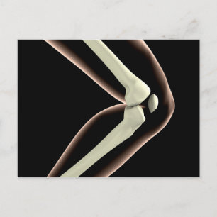Carte Postale Image X-Ray Du Genou 1
