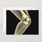 Carte Postale Image X-Ray Du Genou 2 (Devant / Derrière)