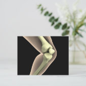 Carte Postale Image X-Ray Du Genou 2 (Debout devant)