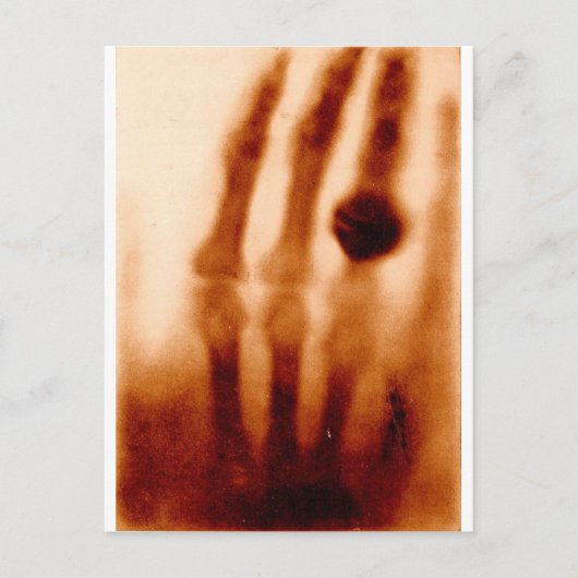 Carte Postale Le premier X-Ray, 1901, photo (Devant)