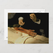 Carte Postale Leçon d'anatomie du Dr Nicolaes Tulp, 1632 (Devant / Derrière)