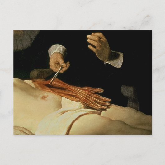 Carte Postale Leçon d'anatomie du Dr Nicolaes Tulp, 1632 (Devant)