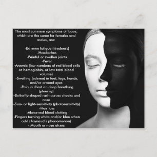 Carte Postale Lupus le partenaire silencieux...