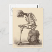 Carte Postale Mes pieds me tuent (Devant / Derrière)