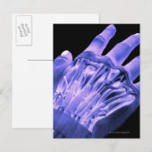 Carte Postale Muscles de la main (Devant / Derrière)