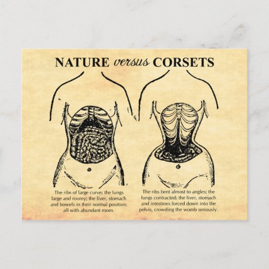 Carte Postale Nature contre Corsets (Devant)