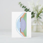 Carte Postale Oeil après chirurgie correctionnelle (Debout devant)