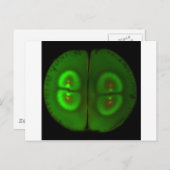 Carte Postale OEuf de grenouille fertilisé (Devant / Derrière)