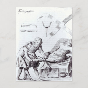 Carte Postale Opération chirurgicale pour amputer une jambe