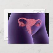 Carte Postale Organe de reproduction féminin, vue par rayons X 2 (Devant / Derrière)