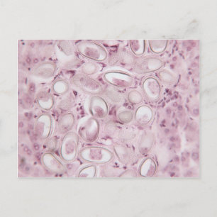 Carte Postale Parasite scientifique