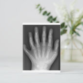 Carte Postale Polydactylo, Six Doigts, X-Ray, rareté ! (Debout devant)