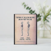 Carte Postale Position Du Squelette En Bonne Et En Mauvaise Posi (Debout devant)